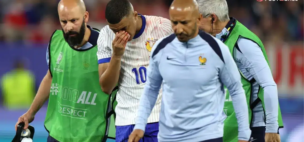 Mbappe to Wear Custom Mask After Suffering Nose Break
