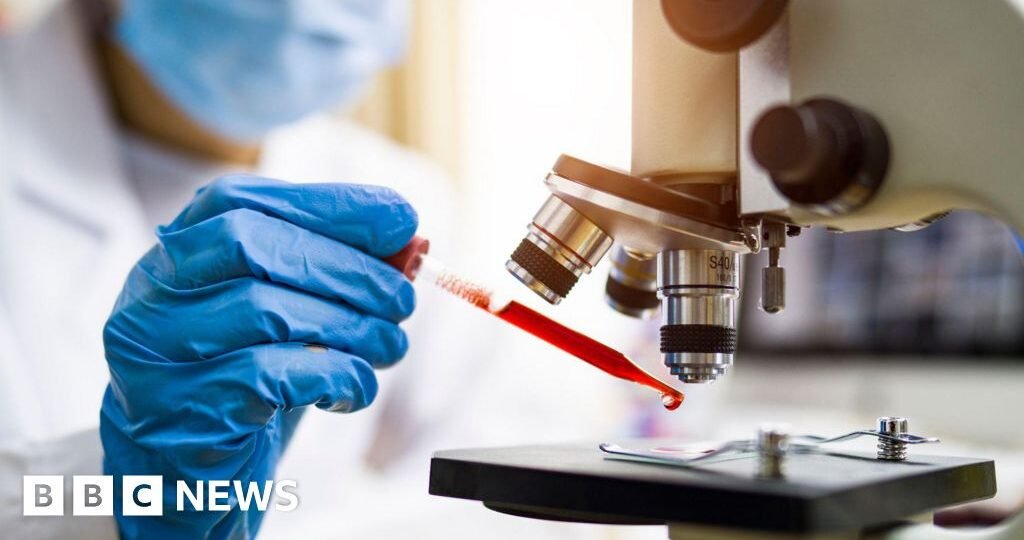 Brazil monitors two patients for possible Ebola infection