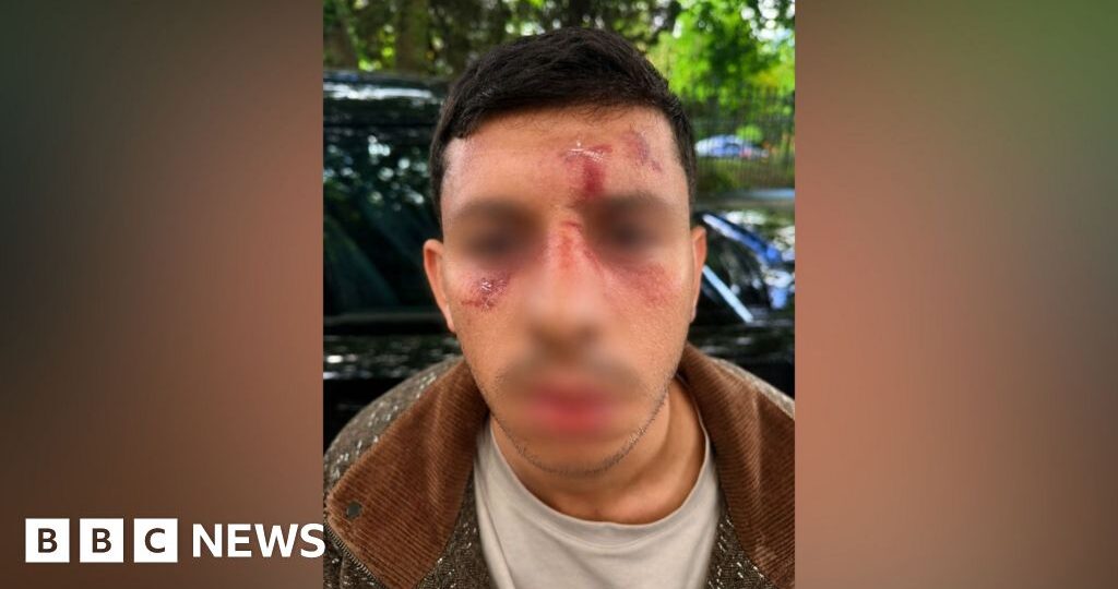 Jewish man ‘kicked like animal’ in new Golders Green attack