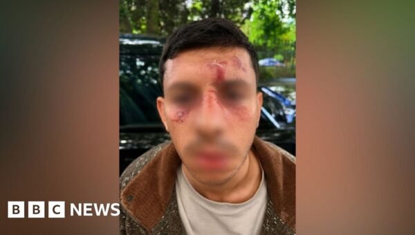 Jewish man ‘kicked like animal’ in new Golders Green attack