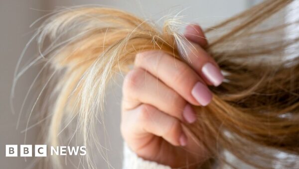 Emily nearly lost access to her baby because of a hair strand test. Experts fear she’s not alone