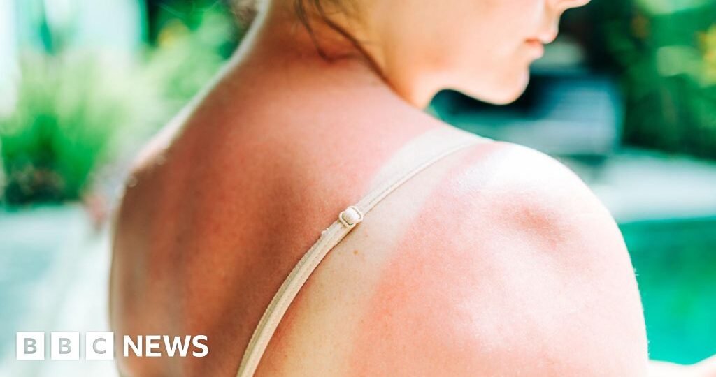 Riskiest skin cancer cases hit UK record high