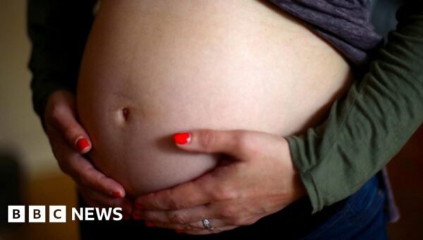 More than 100 maternity staff sue NHS over gas exposure
