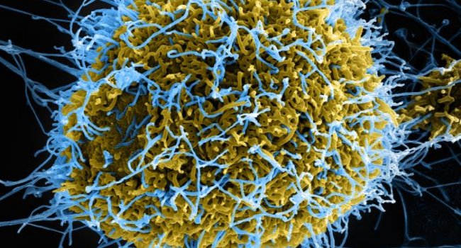 Nigeria Tightens Surveillance, WHO Declares Emergency As Ebola Kills 88 In Congo