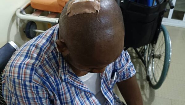 AEDC officials badly injured during anti-electricity theft operation in Abuja Police quarters