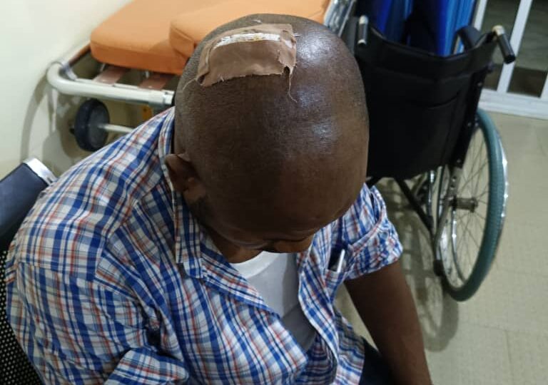 AEDC officials badly injured during anti-electricity theft operation in Abuja Police quarters
