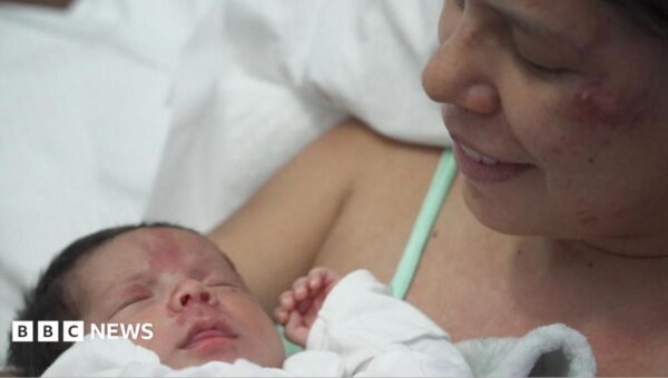 Mum of newborn rescued from Venezuela rubble says baby motivated her to stay alive