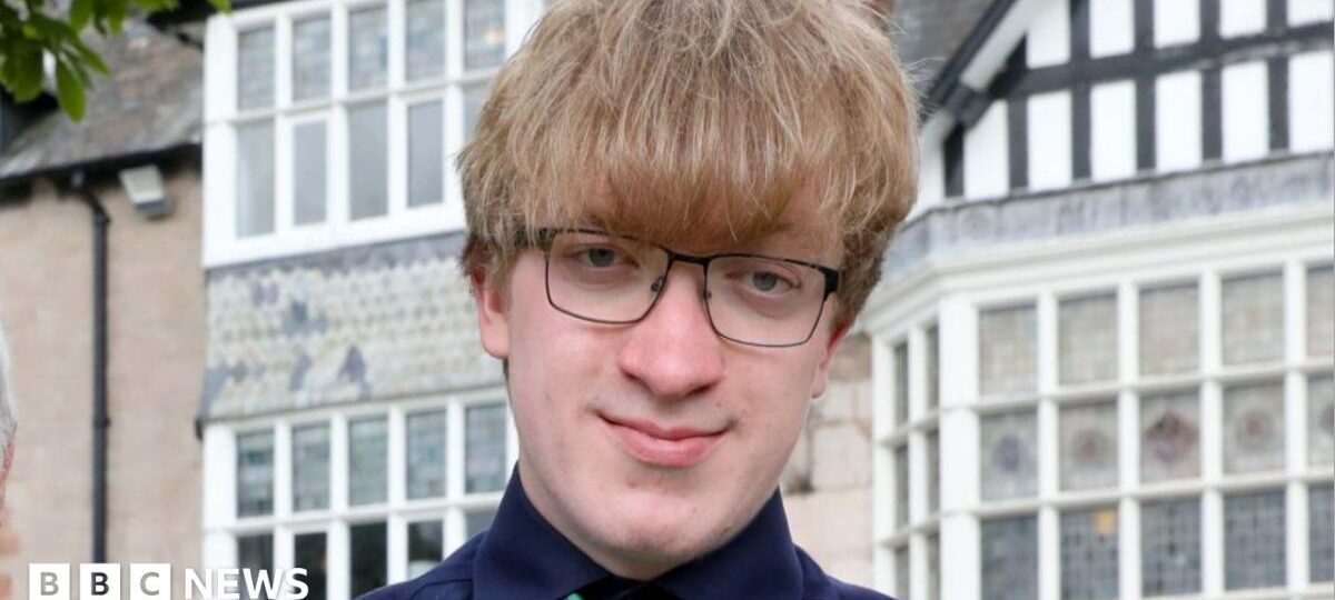 Bullied teen who had 44 surgeries for rare skull condition now training as doctor