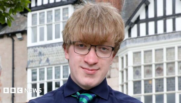 Bullied teen who had 44 surgeries for rare skull condition now training as doctor