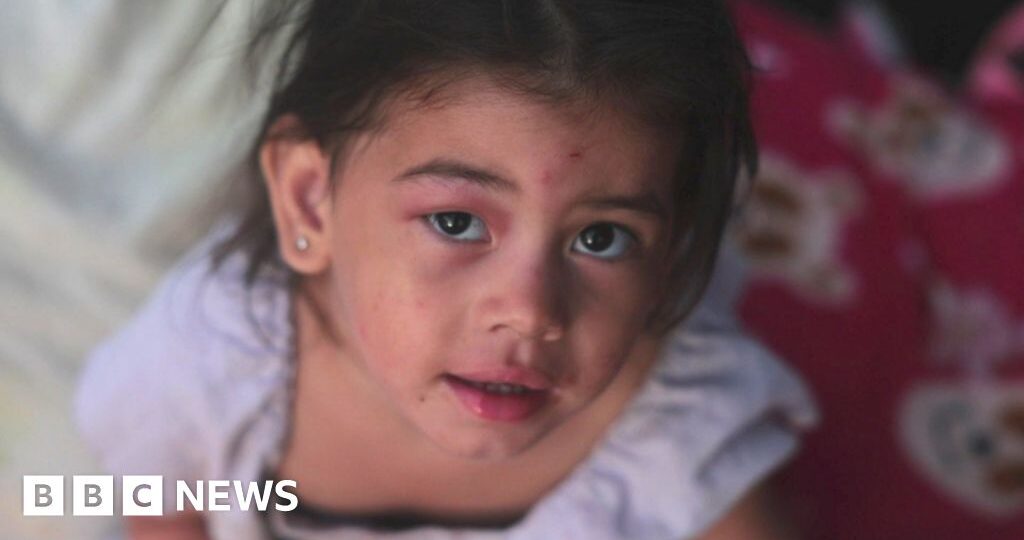 Watch: Inside the Venezuela country club now a makeshift hospital