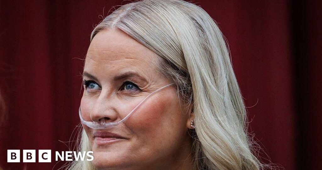 Norway’s crown princess undergoes successful lung transplant, palace says