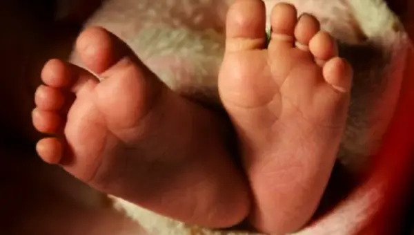 Sickle cell: Lagos begins screening babies within 72 hours of birth