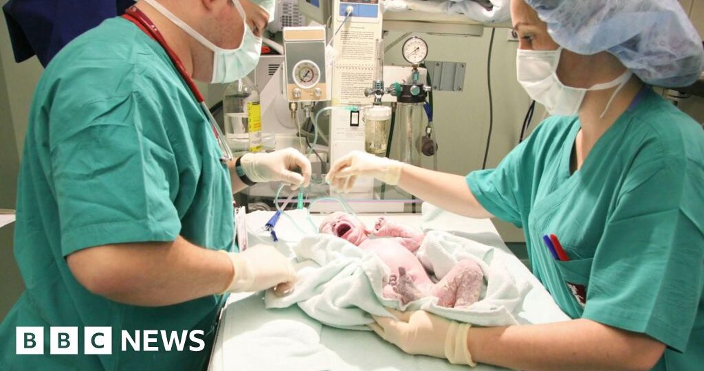 One in four births in England is now emergency caesarean, BBC analysis shows