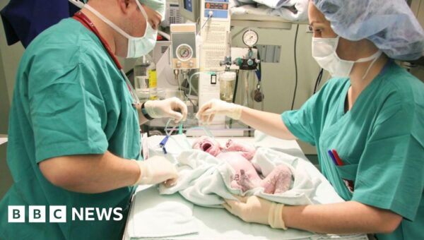 One in four births in England is now emergency caesarean, BBC analysis shows