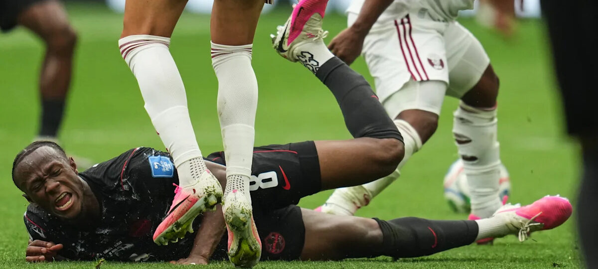One Extraordinary Photo: Canada's Ismael Kone reacts to his injury