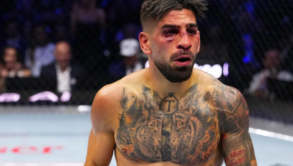 UFC Freedom 250: Ilia Topuria left almost unrecognizable after grisly Justin Gaethje loss, transported to hospital