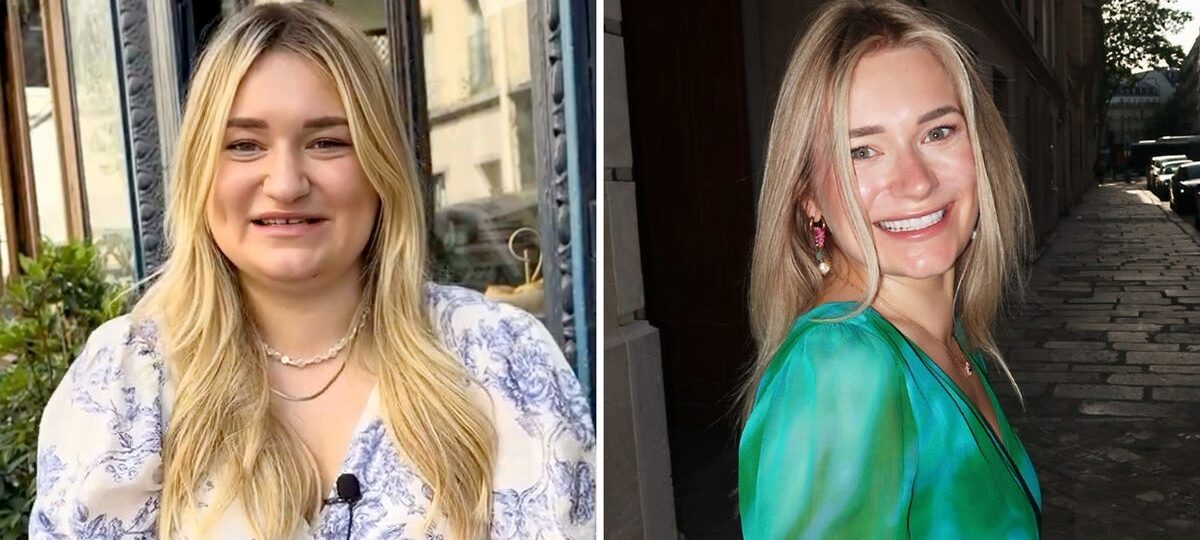 After a break-up, I paid $20K for a glow-up at 28. People on social media accuse me of using AI because I look so different.