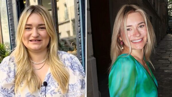 After a break-up, I paid $20K for a glow-up at 28. People on social media accuse me of using AI because I look so different.