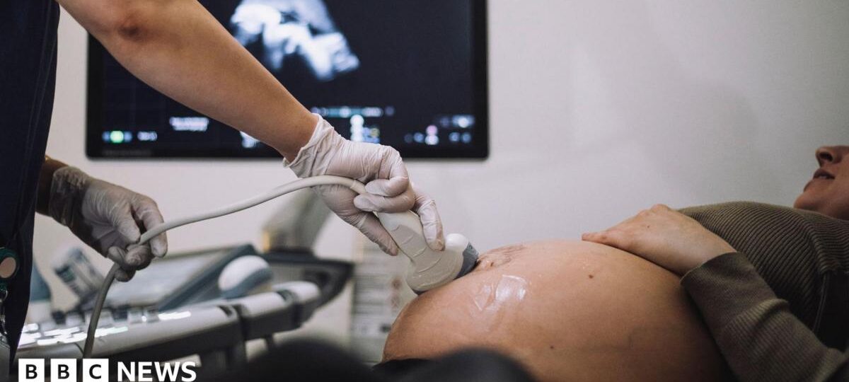 'Normal birth drive' criticism removed from maternity report, expert claims