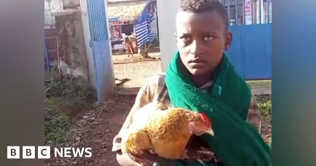 Boy, 12, wins hearts after trying to check sick chicken into Ethiopian hospital