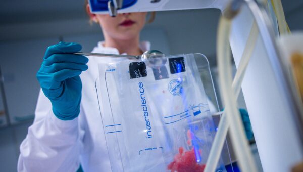 What Is Cyclosporiasis? Learn About the Parasitic Infection