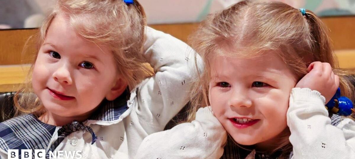 Pioneering treatment saves identical twins from rare pregnancy condition