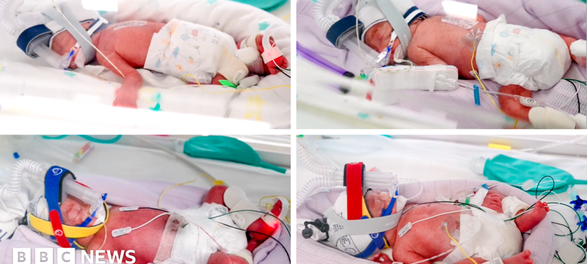 Rare identical quadruplets born in Australia