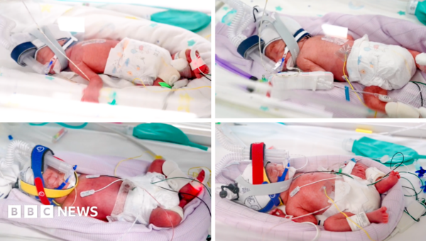 Rare identical quadruplets born in Australia