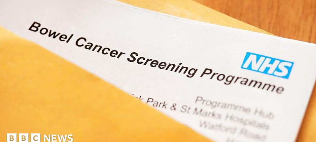 People in 50s urged to complete bowel cancer screening