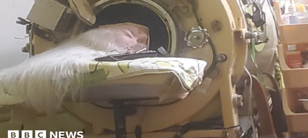 Hours each day in an iron lung kept her breathing, her will to live kept her alive