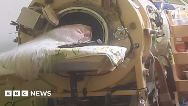 Hours each day in an iron lung kept her breathing, her will to live kept her alive