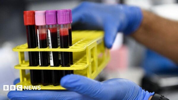 Red Cross declares crisis over blood supply shortage in US for second time its history