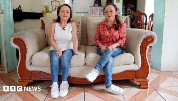 How these twins’ rare growth disorder could provide the key to preventing cancer