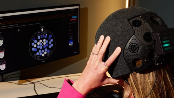 I let Bryan Johnson’s startup scan my brain