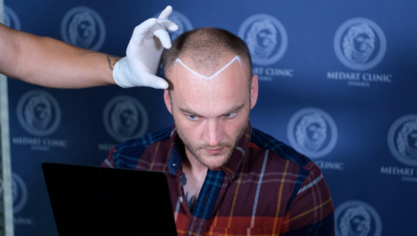 Top 5 Doctor-Led vs Top 5 High-Volume Hair Transplant Turkey Clinics for Complex Cases 2026