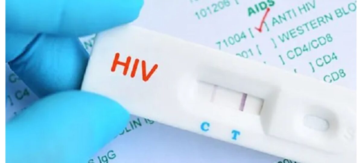 Lagos clarifies reports on 10,430 HIV cases in 2025