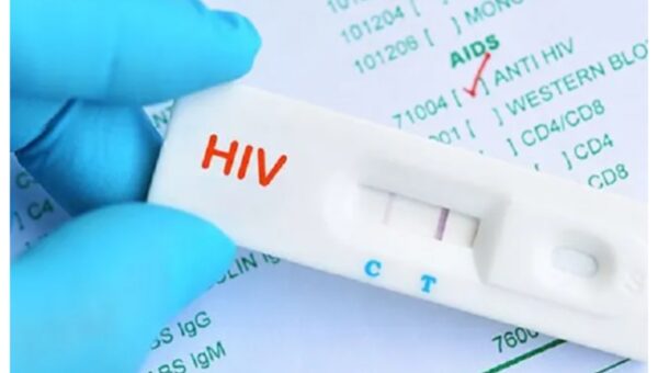 Lagos clarifies reports on 10,430 HIV cases in 2025