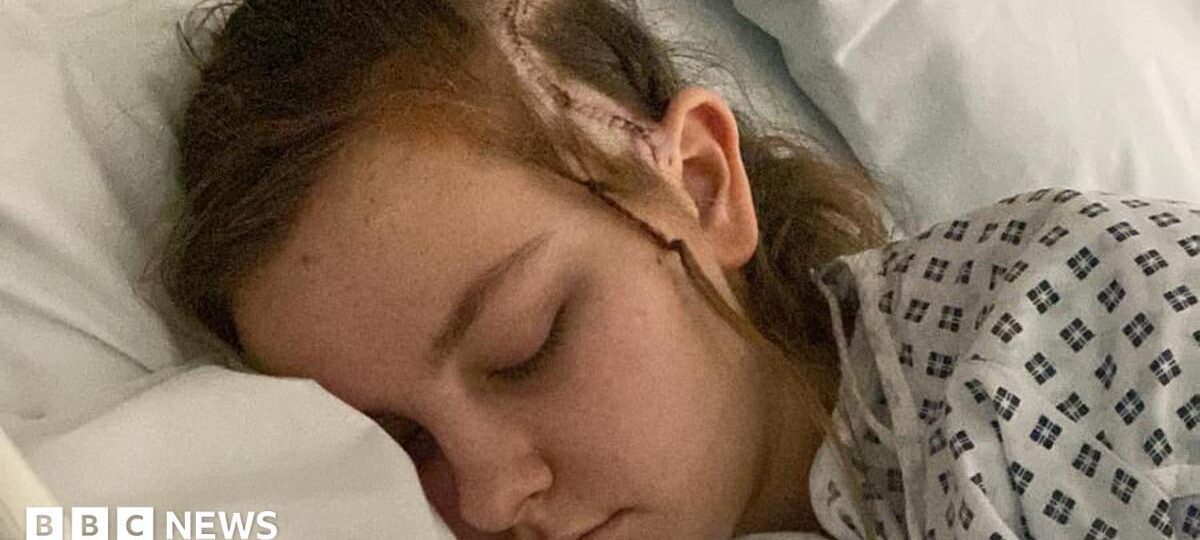 Girl 'youngest' to have conscious brain surgery for condition