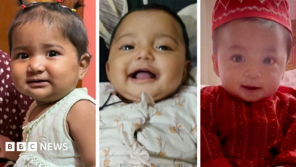 Children keep dying in a country that made huge progress on measles
