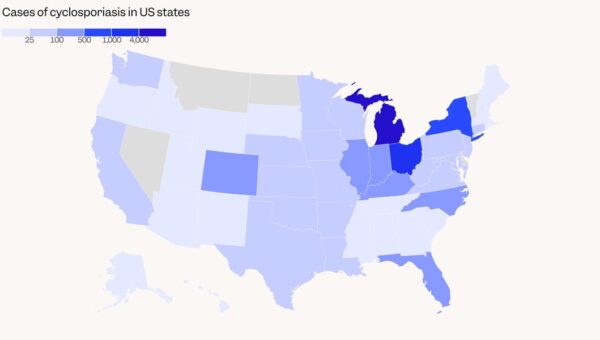 US map shows cyclospora parasite hot spots, as 5 states see the biggest spikes in diarrhea cases