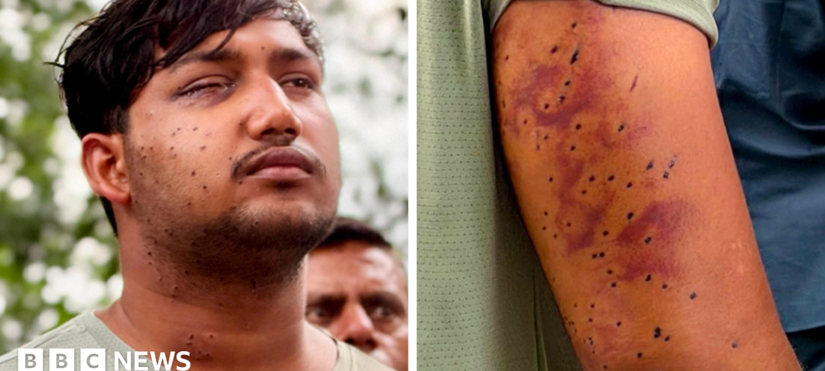 India's 'cockroach' protesters have wounds consistent with pellet-gun fire, say experts