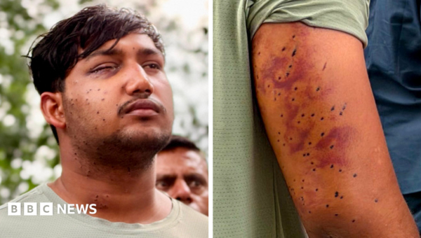 India’s ‘cockroach’ protesters have wounds consistent with pellet-gun fire, say experts