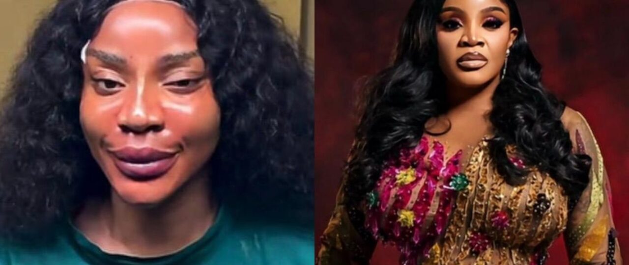 ‘I got me a new face’ – Uche Ogbodo announces threads, fillers, PDO treatments
