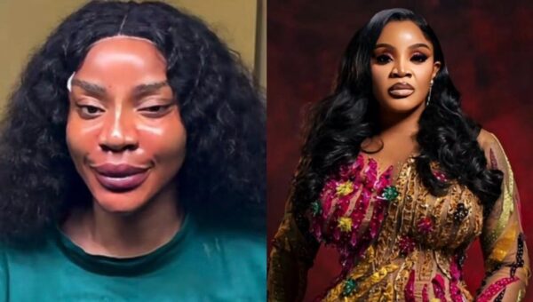 ‘I got me a new face’ – Uche Ogbodo announces threads, fillers, PDO treatments
