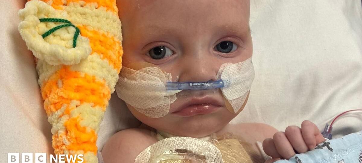 Baby whose parents feared had just days to live is 'thriving' after life-saving heart operation