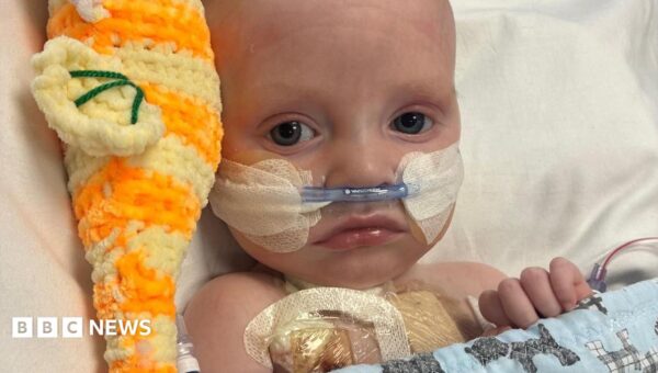 Baby whose parents feared had just days to live is ‘thriving’ after life-saving heart operation