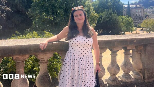 Hypermobility - the little-known 'bendy disease' that causes pain and fatigue