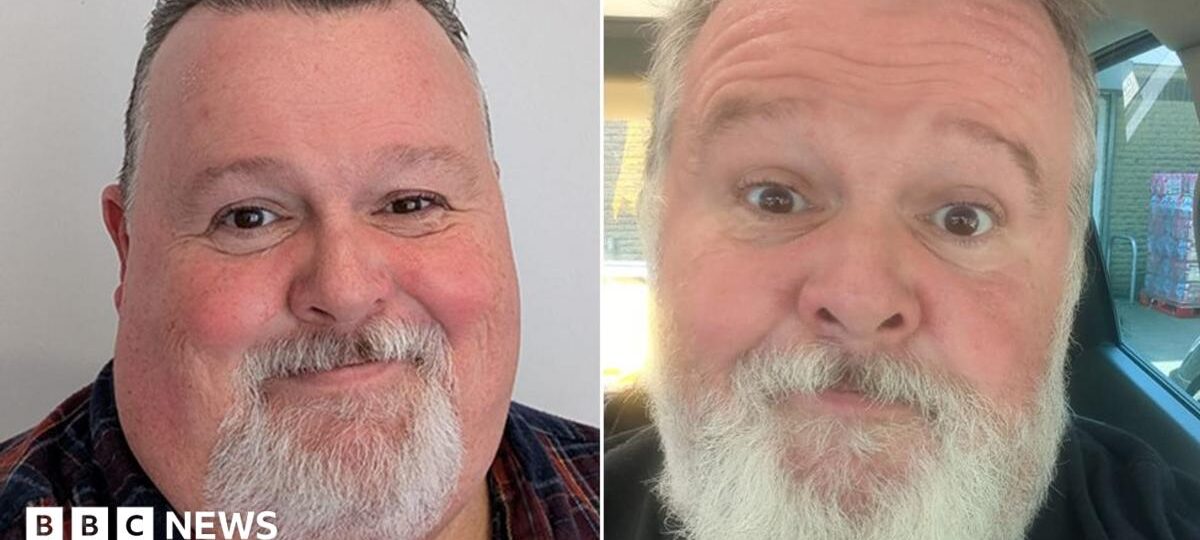 Why don't men talk about using weight-loss drugs?