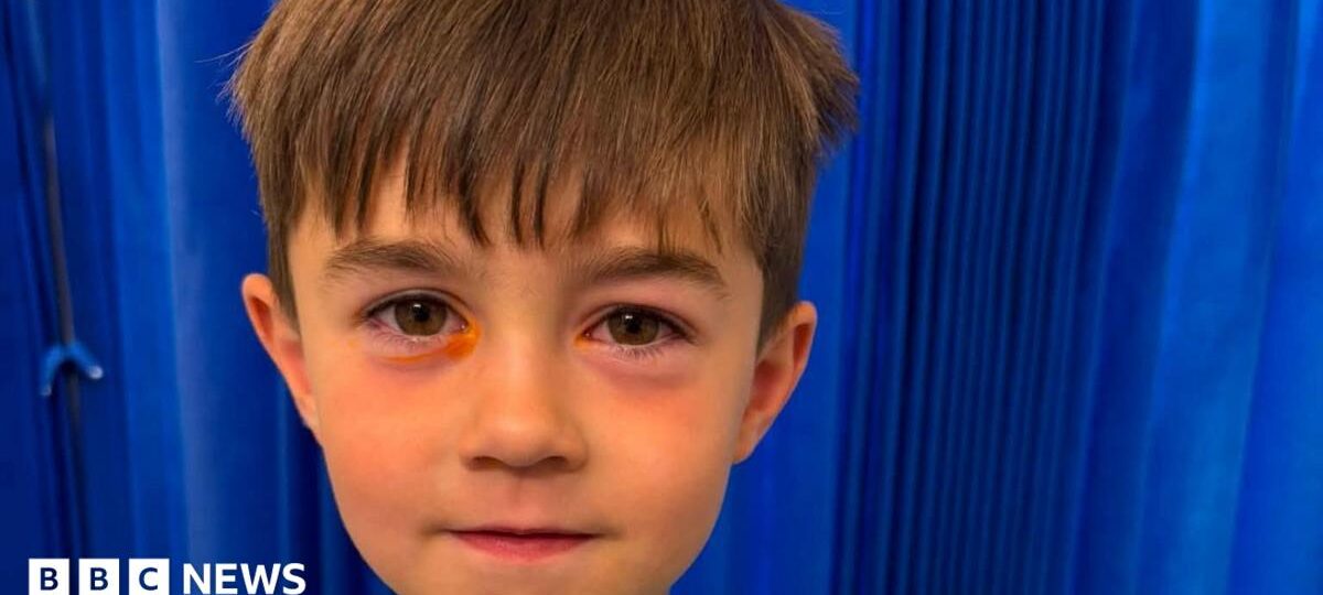 Boy, four, taken to hospital after Shein fake squishy toy explodes in his face