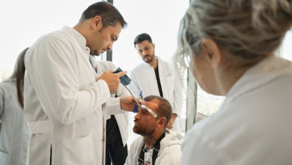 The Celebrity Hairline Effect: What Makes a Hair Transplant Look Natural?